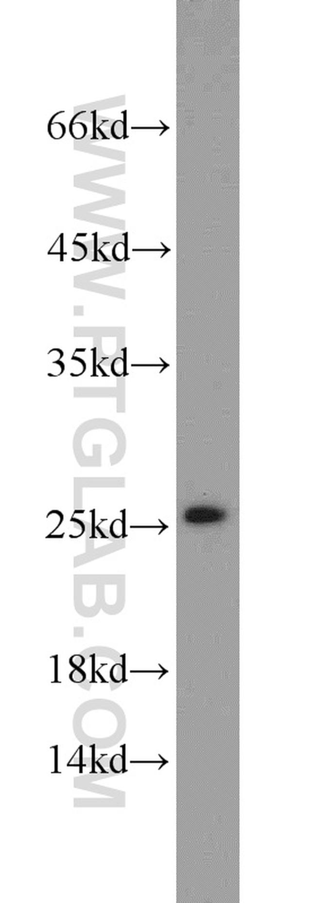 SAR1B Antibody in Western Blot (WB)