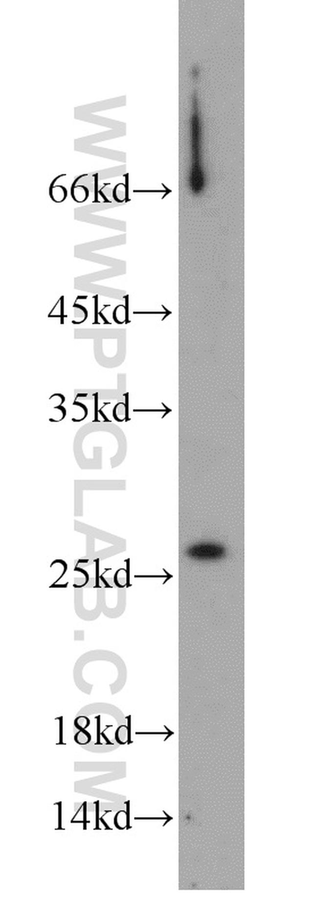 SAR1B Antibody in Western Blot (WB)