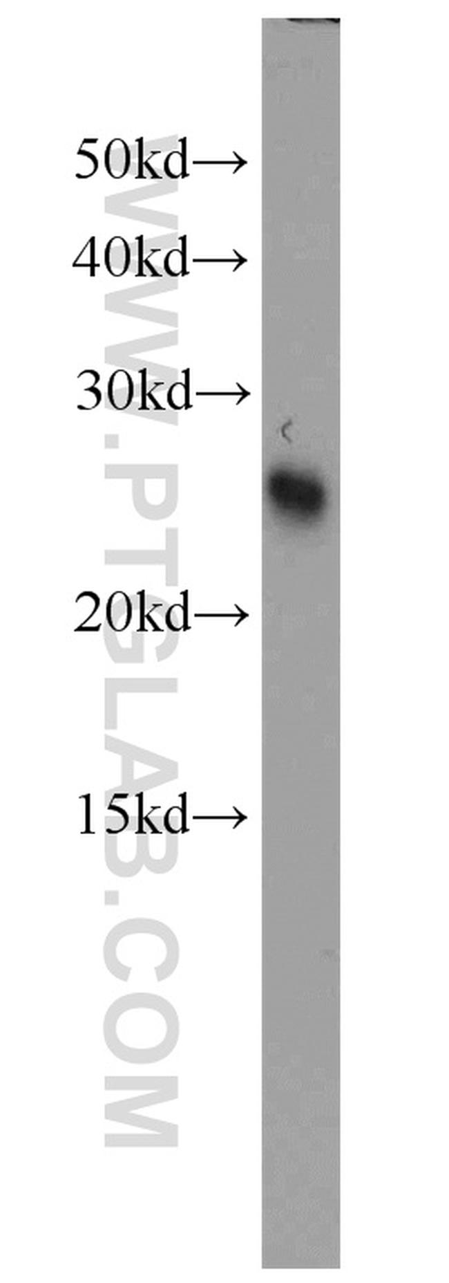 SAR1B Antibody in Western Blot (WB)