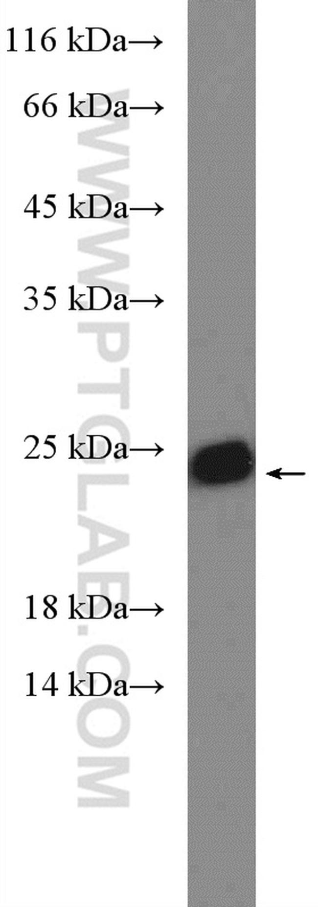 SAR1B Antibody in Western Blot (WB)