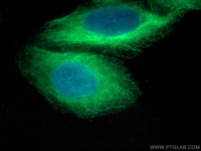 WNK2 Antibody in Immunocytochemistry (ICC/IF)