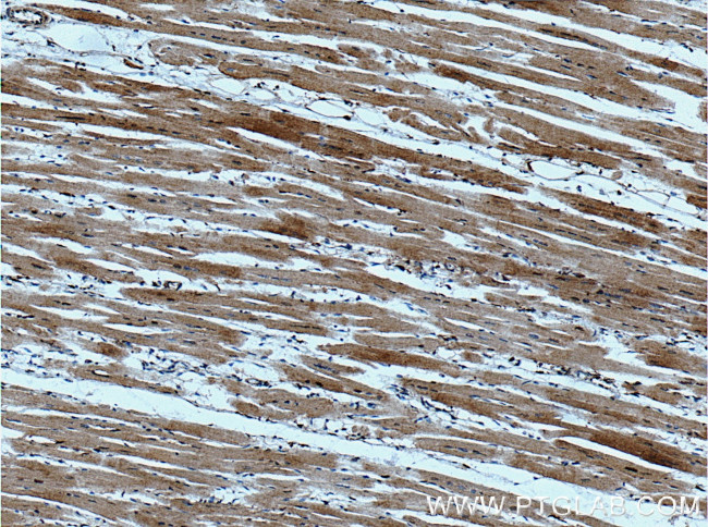 WNK2 Antibody in Immunohistochemistry (Paraffin) (IHC (P))