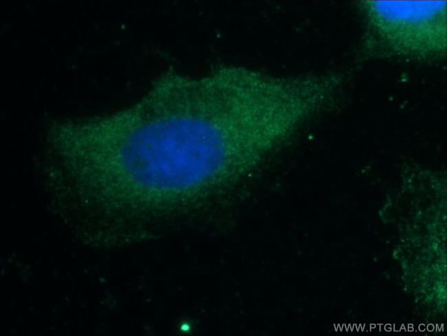 CCL27 Antibody in Immunocytochemistry (ICC/IF)