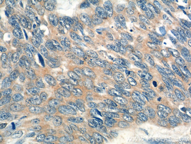 CCL27 Antibody in Immunohistochemistry (Paraffin) (IHC (P))