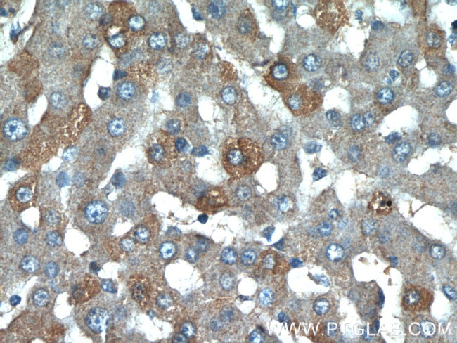 CCL27 Antibody in Immunohistochemistry (Paraffin) (IHC (P))