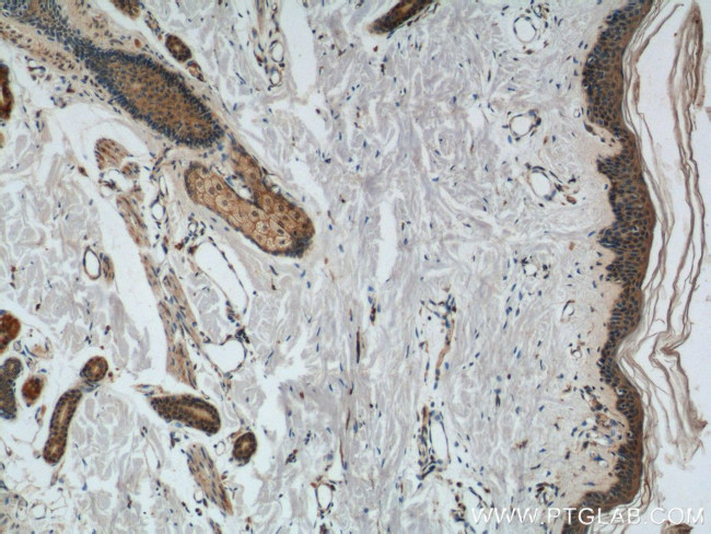 CCL27 Antibody in Immunohistochemistry (Paraffin) (IHC (P))