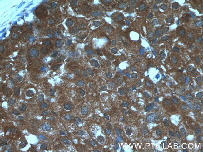 CCL24/Eotaxin 2 Antibody in Immunohistochemistry (Paraffin) (IHC (P))