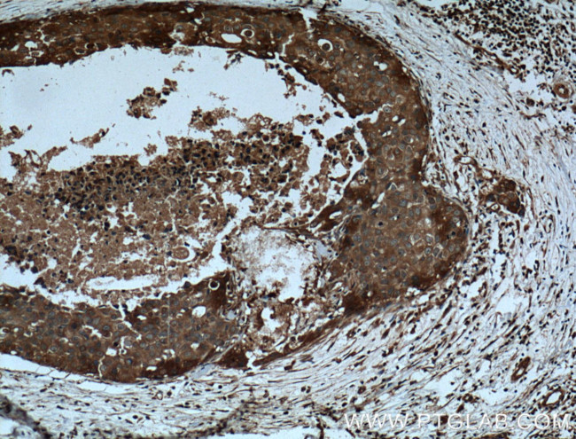 CCL24/Eotaxin 2 Antibody in Immunohistochemistry (Paraffin) (IHC (P))