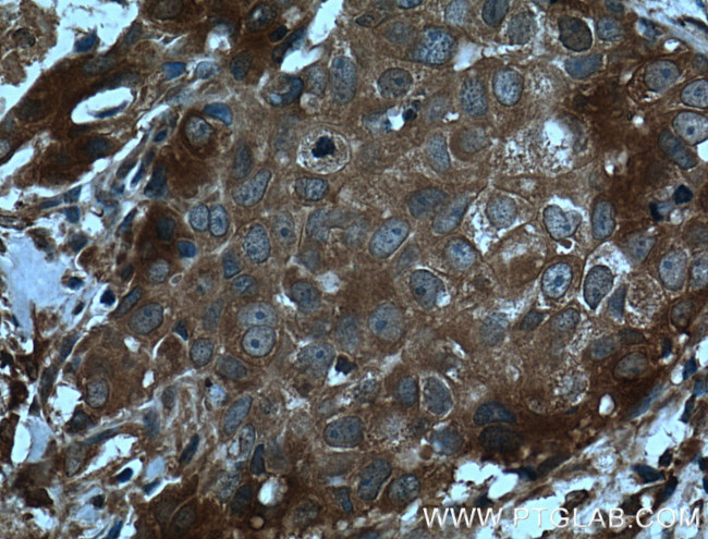 CCL24/Eotaxin 2 Antibody in Immunohistochemistry (Paraffin) (IHC (P))