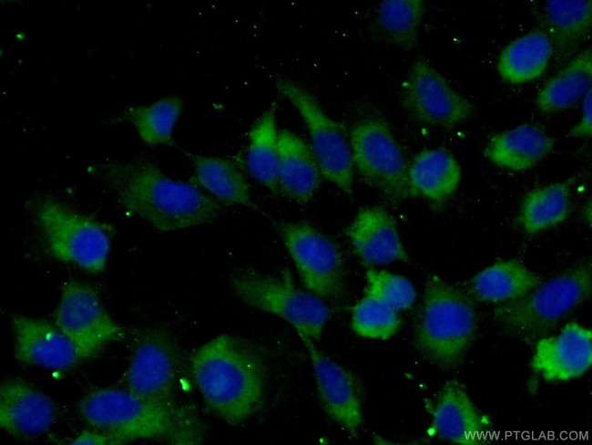 TGF-alpha Antibody in Immunocytochemistry (ICC/IF)