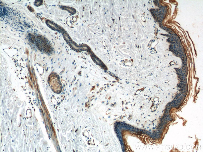 TGF-alpha Antibody in Immunohistochemistry (Paraffin) (IHC (P))