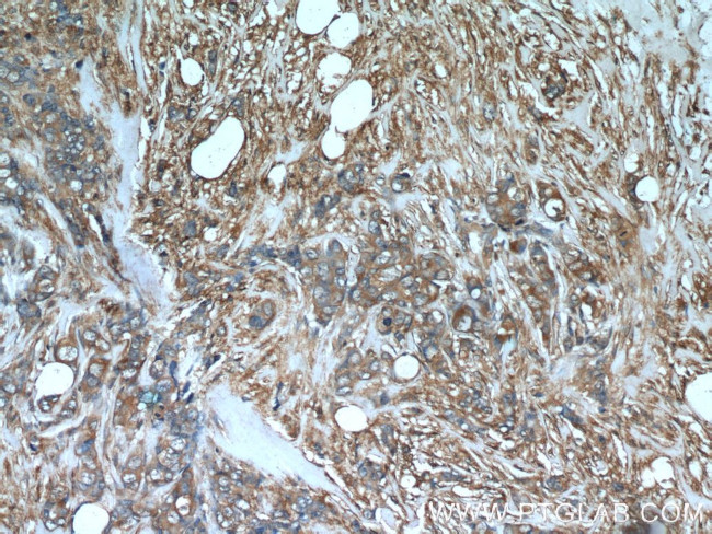 TGF-alpha Antibody in Immunohistochemistry (Paraffin) (IHC (P))