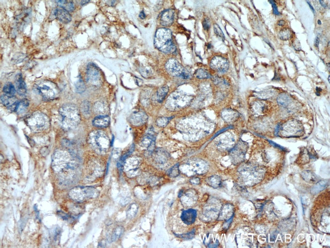 TGF-alpha Antibody in Immunohistochemistry (Paraffin) (IHC (P))