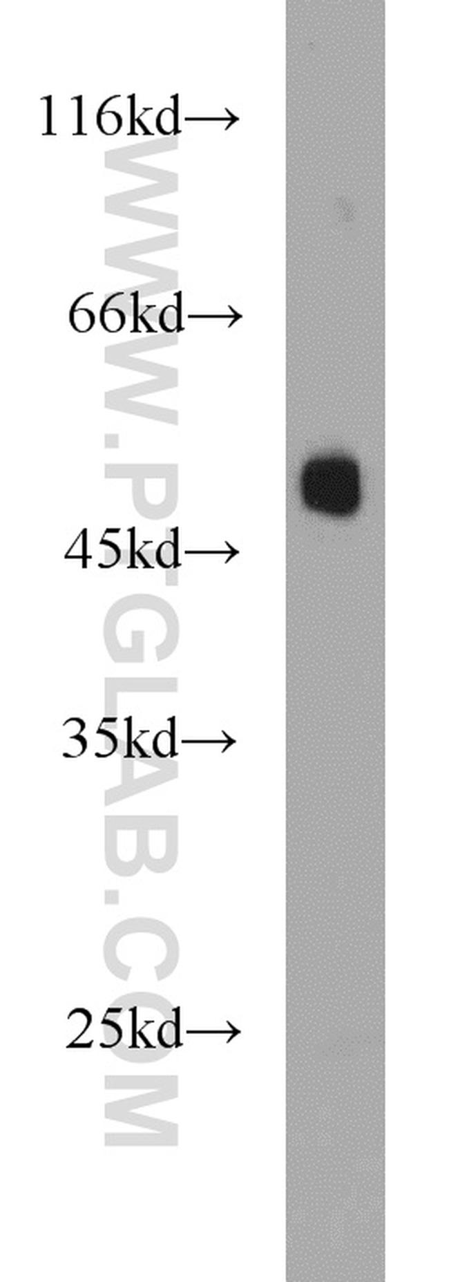 Phospho-TDP43 (Ser409, Ser410) Antibody in Western Blot (WB)