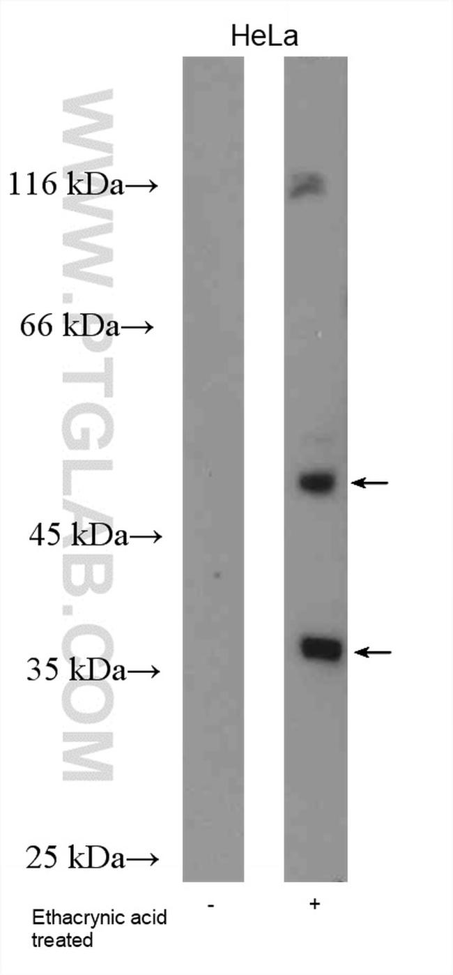 Phospho-TDP43 (Ser409, Ser410) Antibody in Western Blot (WB)