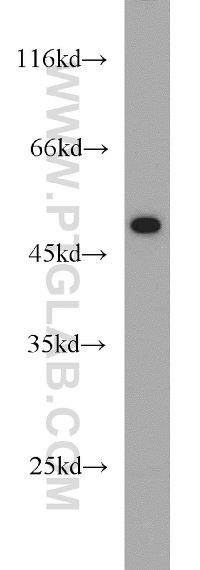 Phospho-TDP43 (Ser409, Ser410) Antibody in Western Blot (WB)