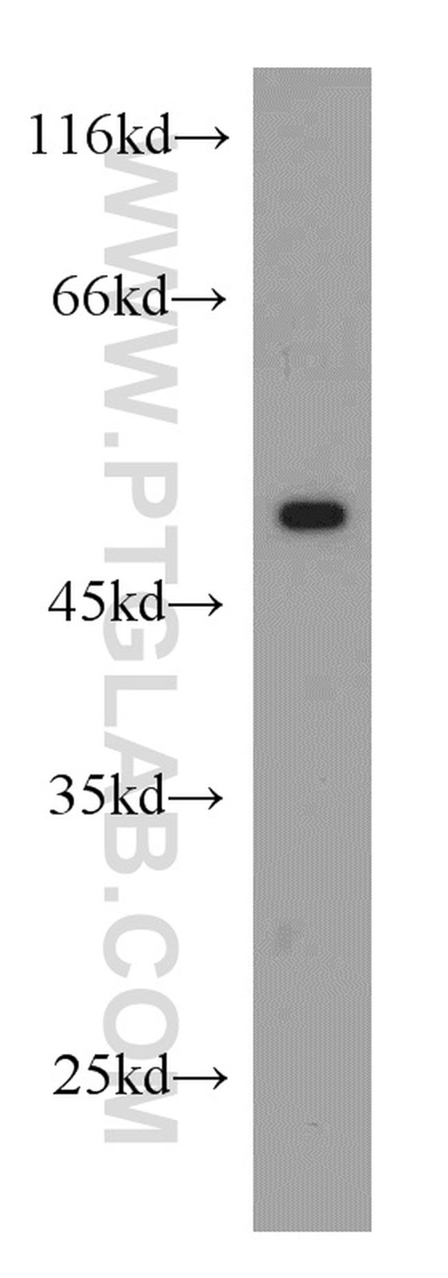 Phospho-TDP43 (Ser409, Ser410) Antibody in Western Blot (WB)