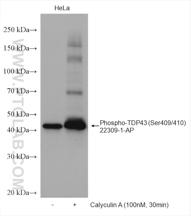 Phospho-TDP43 (Ser409, Ser410) Antibody in Western Blot (WB)