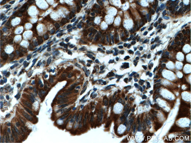 WNK4 Antibody in Immunohistochemistry (Paraffin) (IHC (P))