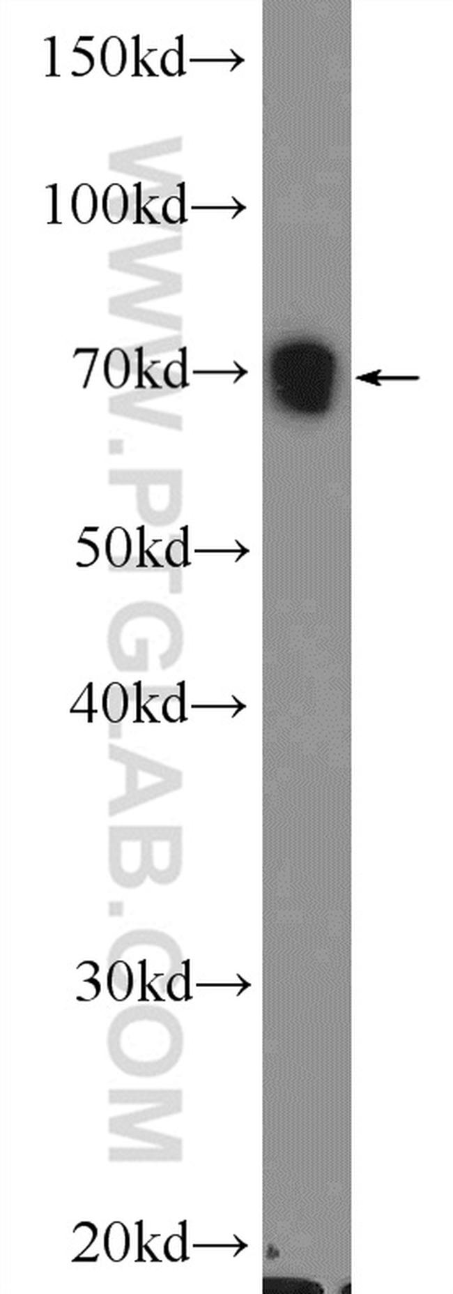 WNK4 Antibody in Western Blot (WB)