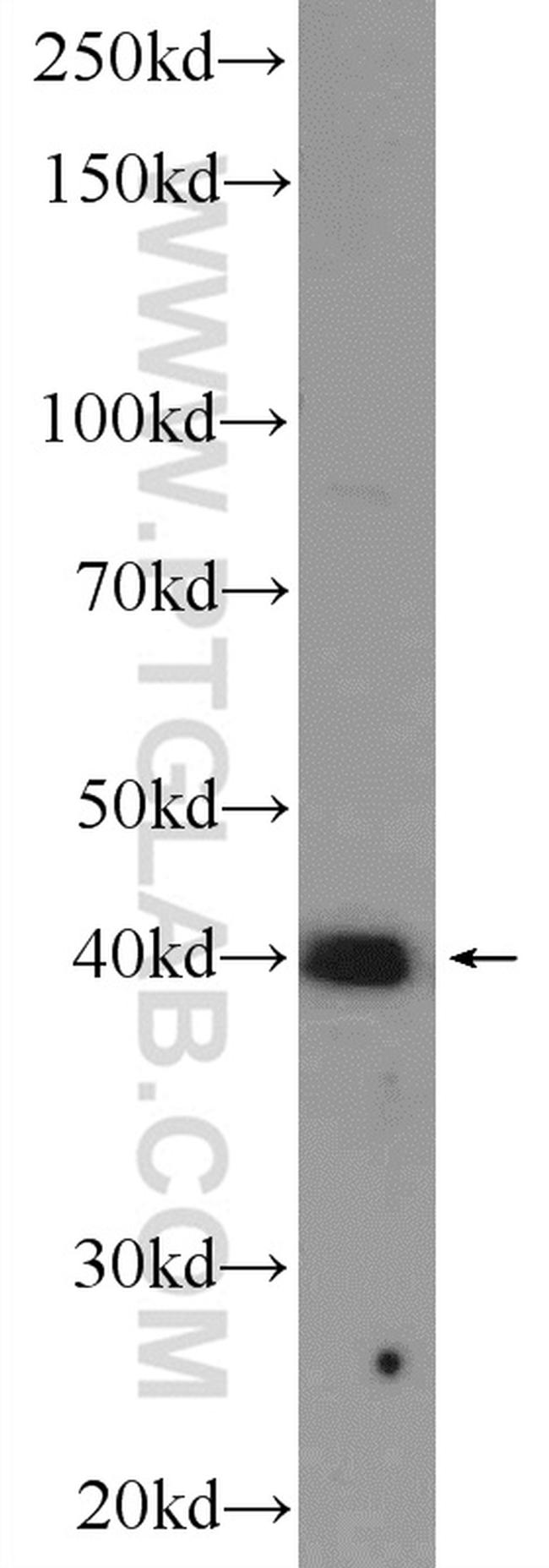 USF1 Antibody in Western Blot (WB)