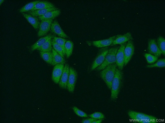 SMN Antibody in Immunocytochemistry (ICC/IF)