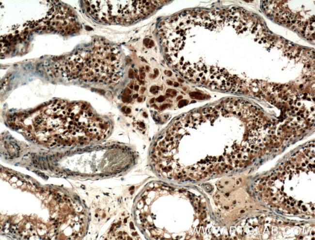 SMN Antibody in Immunohistochemistry (Paraffin) (IHC (P))