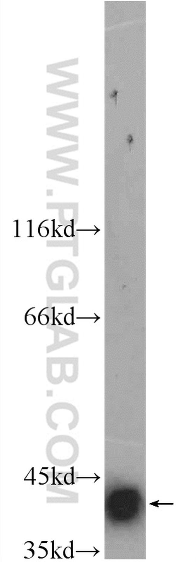 SMN Antibody in Western Blot (WB)