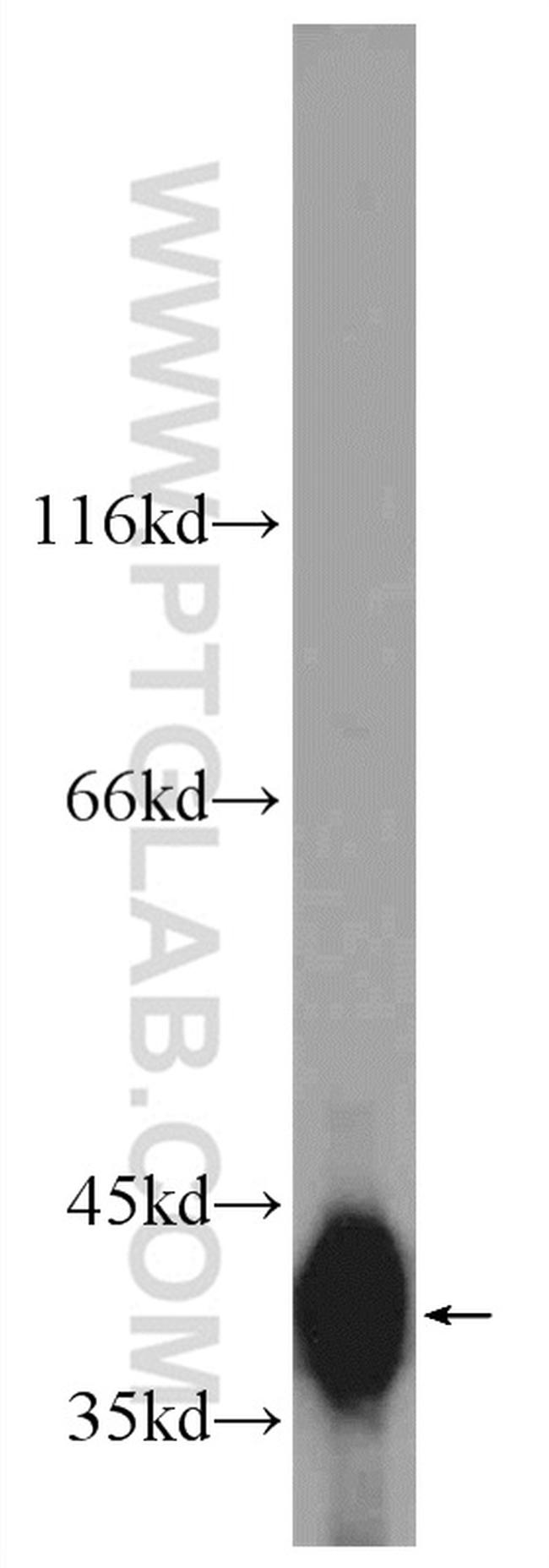 SMN Antibody in Western Blot (WB)