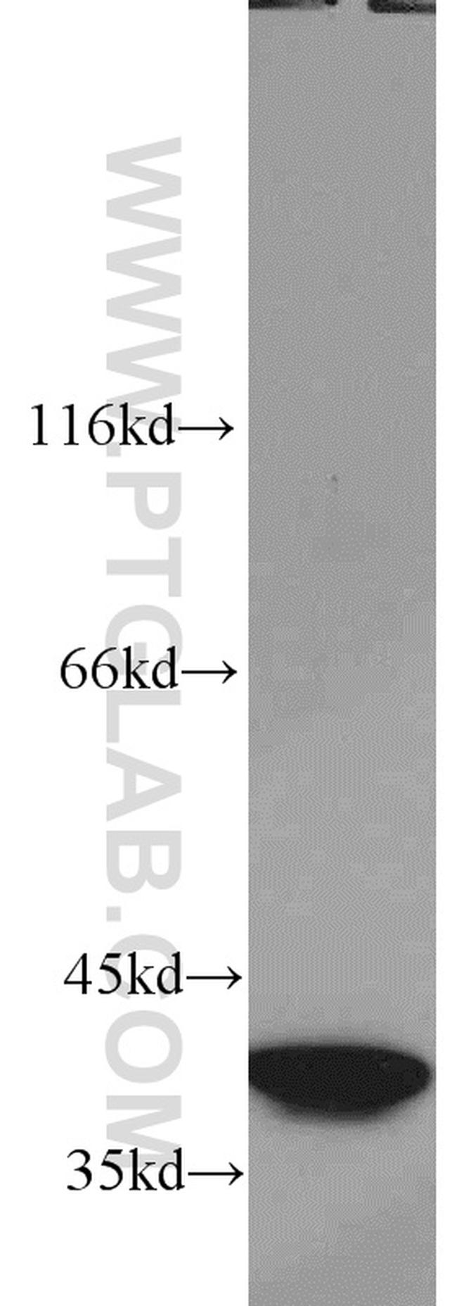 SMN Antibody in Western Blot (WB)