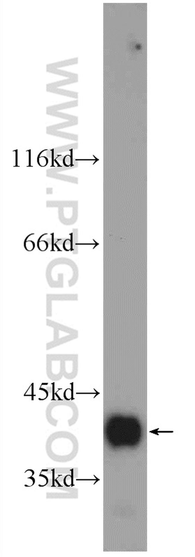 SMN Antibody in Western Blot (WB)