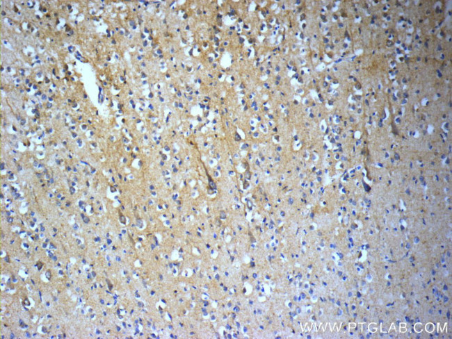 TACR3 Antibody in Immunohistochemistry (Paraffin) (IHC (P))