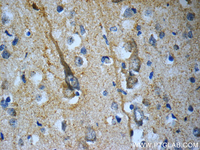 TACR3 Antibody in Immunohistochemistry (Paraffin) (IHC (P))