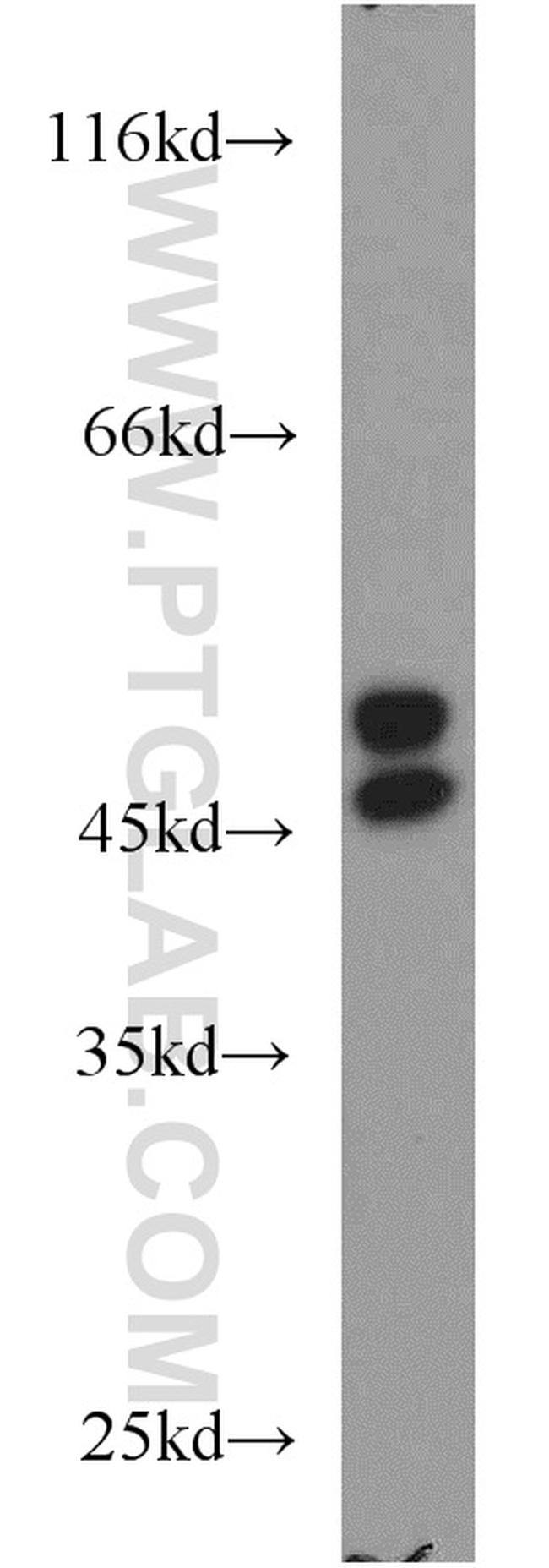 RCC1 Antibody in Western Blot (WB)