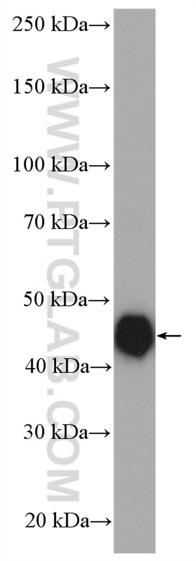 RCC1 Antibody in Western Blot (WB)