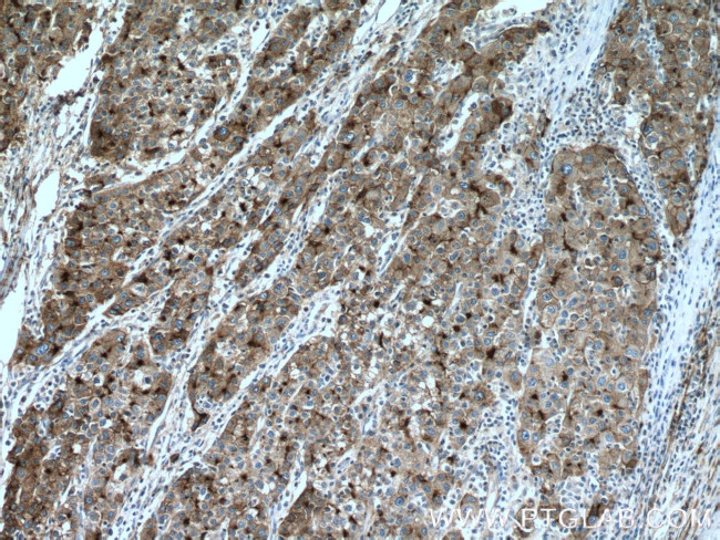 P glycoprotein Antibody in Immunohistochemistry (Paraffin) (IHC (P))