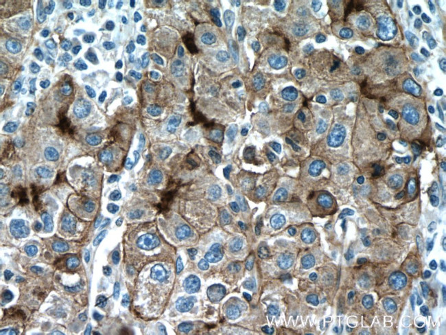 P glycoprotein Antibody in Immunohistochemistry (Paraffin) (IHC (P))