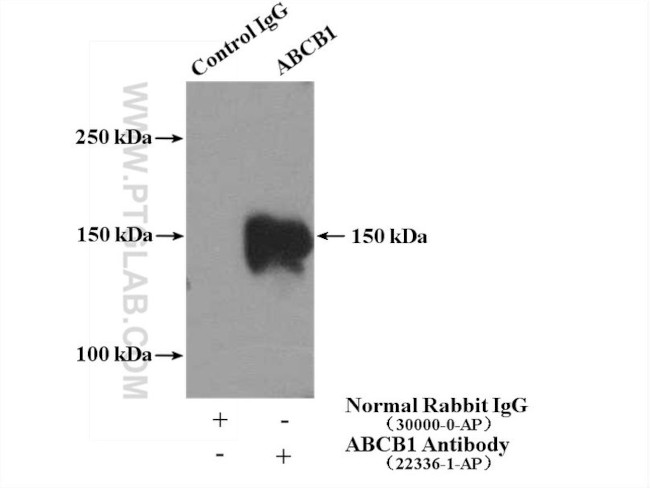 P glycoprotein Antibody in Immunoprecipitation (IP)