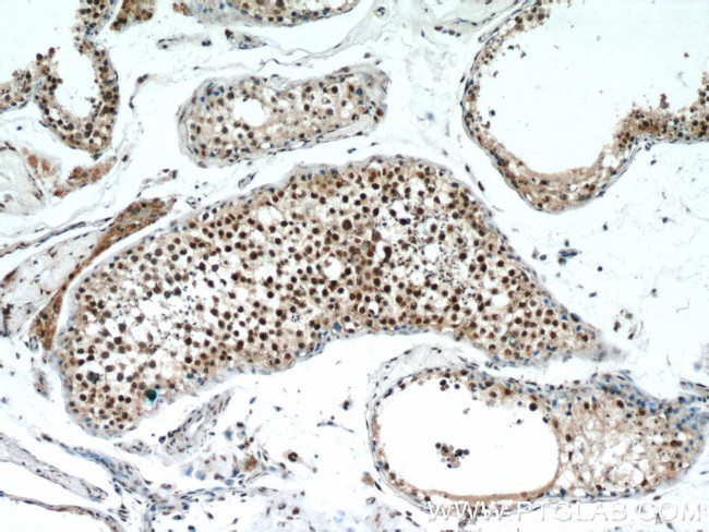 TCF4 Antibody in Immunohistochemistry (Paraffin) (IHC (P))