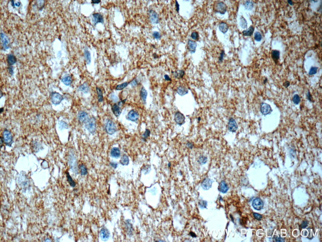 ATP1B2 Antibody in Immunohistochemistry (Paraffin) (IHC (P))