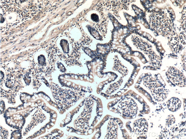 BTG2 Antibody in Immunohistochemistry (Paraffin) (IHC (P))