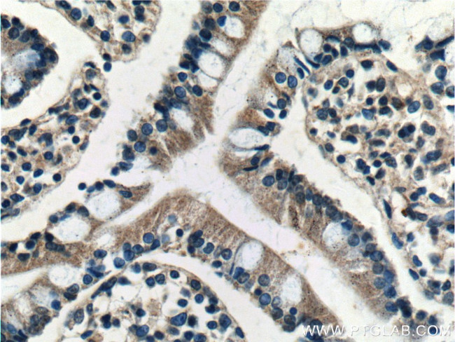 BTG2 Antibody in Immunohistochemistry (Paraffin) (IHC (P))