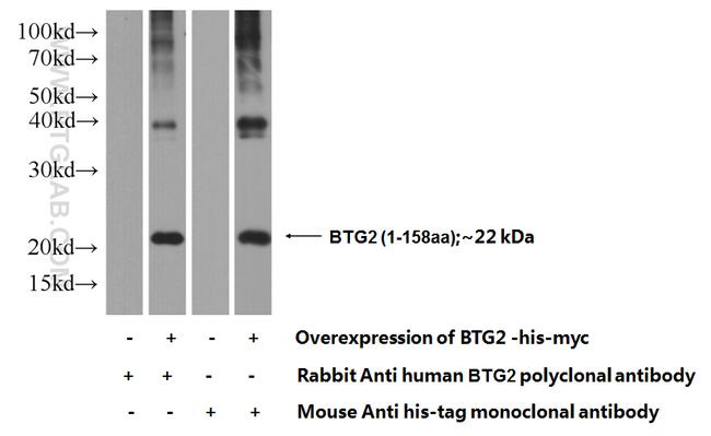 BTG2 Antibody in Western Blot (WB)