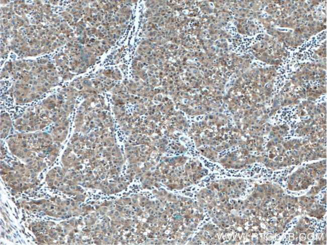 L-VEGFA Antibody in Immunohistochemistry (Paraffin) (IHC (P))