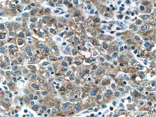 L-VEGFA Antibody in Immunohistochemistry (Paraffin) (IHC (P))