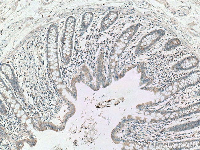 CCL17 Antibody in Immunohistochemistry (Paraffin) (IHC (P))