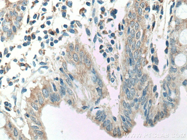 CCL17 Antibody in Immunohistochemistry (Paraffin) (IHC (P))