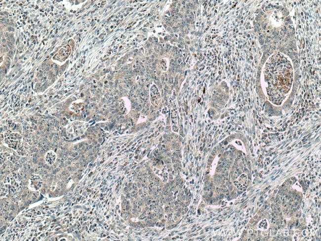 CCL17 Antibody in Immunohistochemistry (Paraffin) (IHC (P))