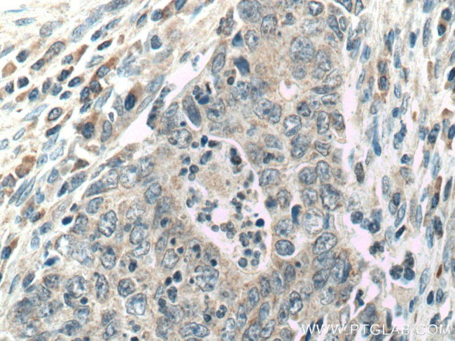 CCL17 Antibody in Immunohistochemistry (Paraffin) (IHC (P))