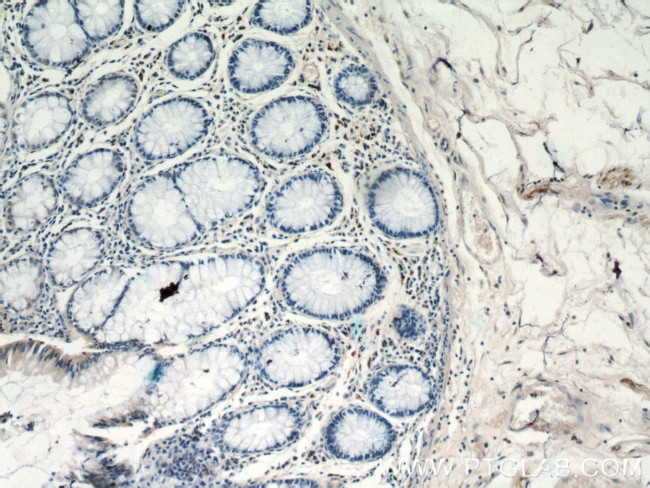 CCL17 Antibody in Immunohistochemistry (Paraffin) (IHC (P))